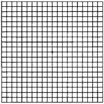 Amsler Grid - Free Printable PDF, Eye Specialist Institute