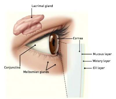 Dry-Eye-400x340