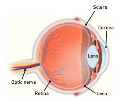 Uveitis-400x339