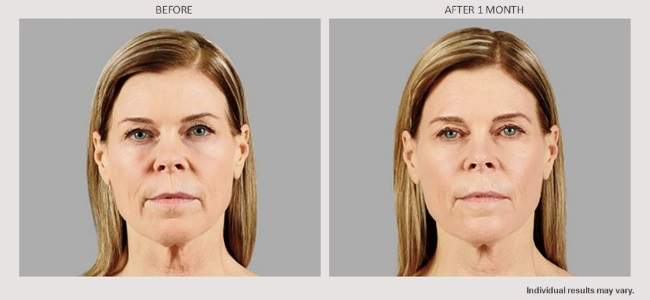 VolumaXC-BA-650x300